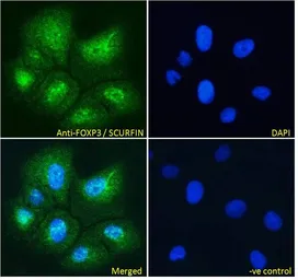 Anti-FOXP3 antibody used in Immunocytochemistry/ Immunofluorescence (ICC/IF). GTX04725