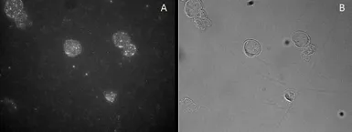 Anti-FOXP3 antibody used in Immunocytochemistry/ Immunofluorescence (ICC/IF). GTX04725