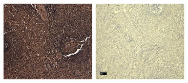 Anti-FOXP3 antibody used in IHC (Paraffin sections) (IHC-P). GTX04725