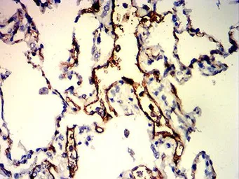 Anti-CD109 antibody [3B5G6] used in IHC (Paraffin sections) (IHC-P). GTX04727