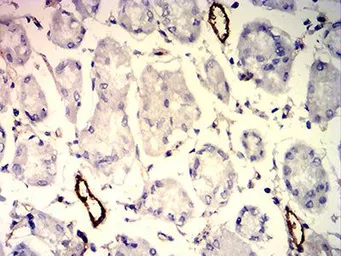 Anti-CD109 antibody [3B5G6] used in IHC (Paraffin sections) (IHC-P). GTX04727