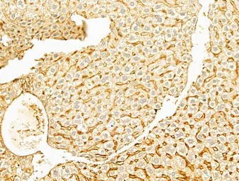 Anti-YAP1 (phospho Ser127) antibody used in IHC (Paraffin sections) (IHC-P). GTX04728