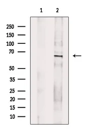 Anti-YAP1 (phospho Ser127) antibody used in Western Blot (WB). GTX04728