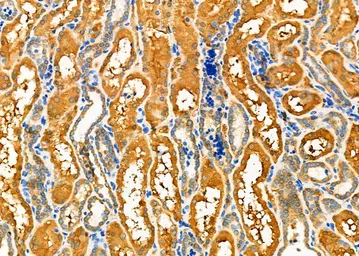 Anti-Fc epsilon R1 alpha antibody used in IHC (Paraffin sections) (IHC-P). GTX04729