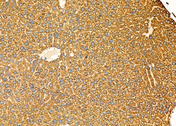 Anti-Fc epsilon R1 alpha antibody used in IHC (Paraffin sections) (IHC-P). GTX04729