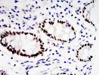 Anti-PEA3 antibody used in IHC (Paraffin sections) (IHC-P). GTX04730