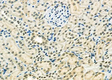 Anti-PEA3 antibody used in IHC (Paraffin sections) (IHC-P). GTX04730
