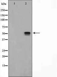 Anti-PEA3 antibody used in Western Blot (WB). GTX04730