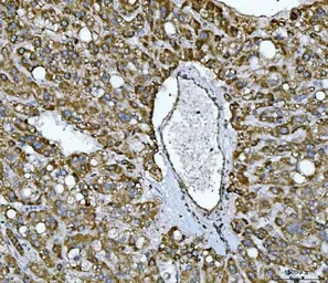 Anti-NDUFS2 antibody used in IHC (Paraffin sections) (IHC-P). GTX04733