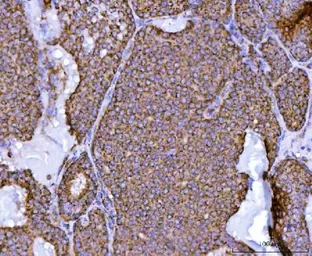 Anti-NDUFS2 antibody used in IHC (Paraffin sections) (IHC-P). GTX04733