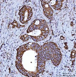 Anti-NDUFS2 antibody used in IHC (Paraffin sections) (IHC-P). GTX04733