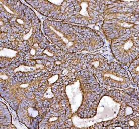 Anti-NDUFS2 antibody used in IHC (Paraffin sections) (IHC-P). GTX04733