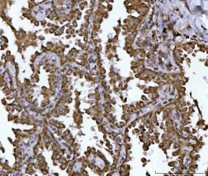Anti-NDUFS2 antibody used in IHC (Paraffin sections) (IHC-P). GTX04733
