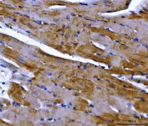 Anti-NDUFS2 antibody used in IHC (Paraffin sections) (IHC-P). GTX04733