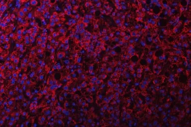 Anti-NDUFS2 antibody used in IHC (Paraffin sections) (IHC-P). GTX04733