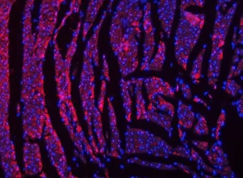 Anti-NDUFS2 antibody used in IHC (Paraffin sections) (IHC-P). GTX04733