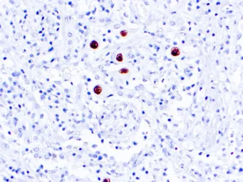 Anti-Cytomegalovirus antibody [DDG9 + CCH2] used in IHC (Paraffin sections) (IHC-P). GTX04739