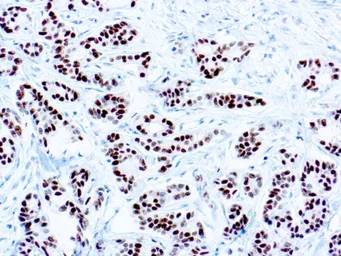 Anti-Estrogen Receptor antibody [SP1] used in IHC (Paraffin sections) (IHC-P). GTX04741