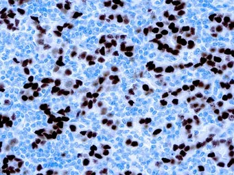 Anti-Progesterone Receptor antibody [SP2] used in IHC (Paraffin sections) (IHC-P). GTX04742