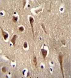 Anti-FBXO39 antibody, C-term used in IHC (Paraffin sections) (IHC-P). GTX04746