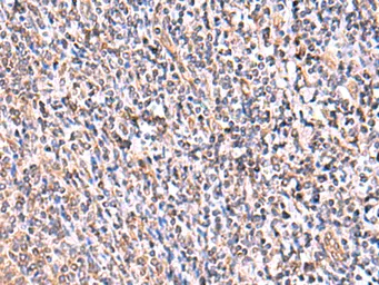 Anti-UXS1 antibody used in IHC (Paraffin sections) (IHC-P). GTX04750