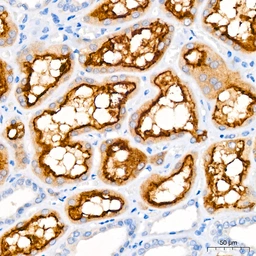 Anti-LRP2 antibody [ARC63830] used in IHC (Paraffin sections) (IHC-P). GTX04758