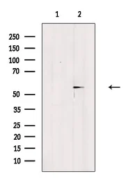 Anti-Estrogen Receptor beta (phospho Ser87) antibody used in Western Blot (WB). GTX04766
