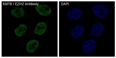 Anti-EZH2 antibody [IDF-5] used in Immunocytochemistry/ Immunofluorescence (ICC/IF). GTX04778