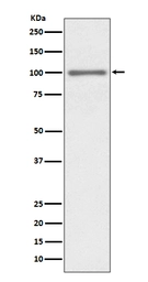 Anti-EZH2 antibody [IDF-5] used in Western Blot (WB). GTX04778