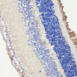Anti-ROM1 antibody used in IHC (Paraffin sections) (IHC-P). GTX04780