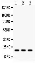 Anti-Syndecan 4 antibody used in Western Blot (WB). GTX04782