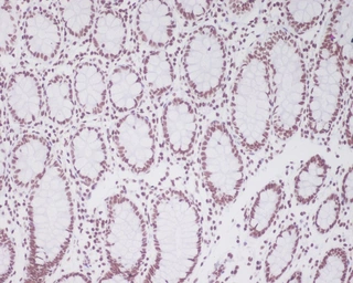 Anti-PAX2 antibody [BDA-16] used in IHC (Paraffin sections) (IHC-P). GTX04785