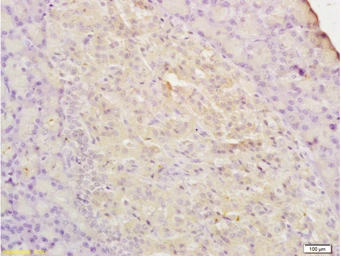 Anti-PAX2 antibody used in IHC (Paraffin sections) (IHC-P). GTX04786