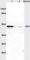 Anti-PAX2 antibody used in Western Blot (WB). GTX04786