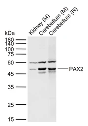 Anti-PAX2 antibody used in Western Blot (WB). GTX04786