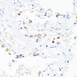 Anti-Cathelicidin antibody used in IHC (Paraffin sections) (IHC-P). GTX04791