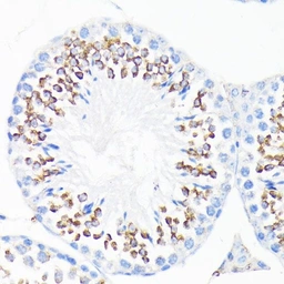 Anti-Cathelicidin antibody used in IHC (Paraffin sections) (IHC-P). GTX04791