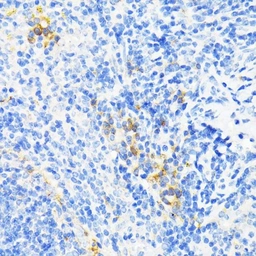 Anti-Cathelicidin antibody used in IHC (Paraffin sections) (IHC-P). GTX04791