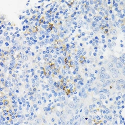 Anti-Cathelicidin antibody used in IHC (Paraffin sections) (IHC-P). GTX04791