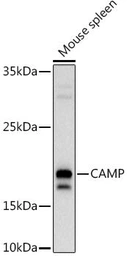 Anti-Cathelicidin antibody used in Western Blot (WB). GTX04791