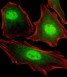 Anti-FUBP3 antibody [1216CT820.155.150] used in Immunocytochemistry/ Immunofluorescence (ICC/IF). GTX04792