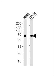 Anti-FUBP3 antibody [1216CT820.155.150] used in Western Blot (WB). GTX04792