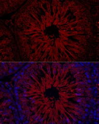 Anti-GPX4 antibody used in IHC (Paraffin sections) (IHC-P). GTX04794