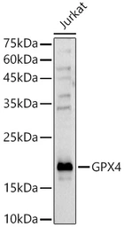 Anti-GPX4 antibody used in Western Blot (WB). GTX04794