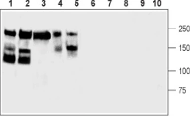 Anti-NCAM antibody used in Western Blot (WB). GTX04796