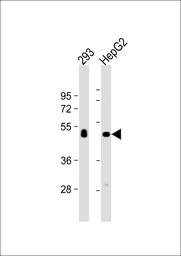 Anti-CPVL antibody used in Western Blot (WB). GTX04800