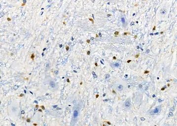 Anti-DCP1A antibody used in IHC (Paraffin sections) (IHC-P). GTX04801