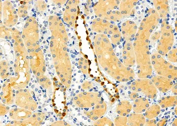 Anti-DCP1A antibody used in IHC (Paraffin sections) (IHC-P). GTX04801
