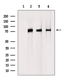 Anti-DCP1A antibody used in Western Blot (WB). GTX04801