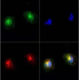 Anti-TRPM2 antibody used in Immunocytochemistry/ Immunofluorescence (ICC/IF). GTX04802